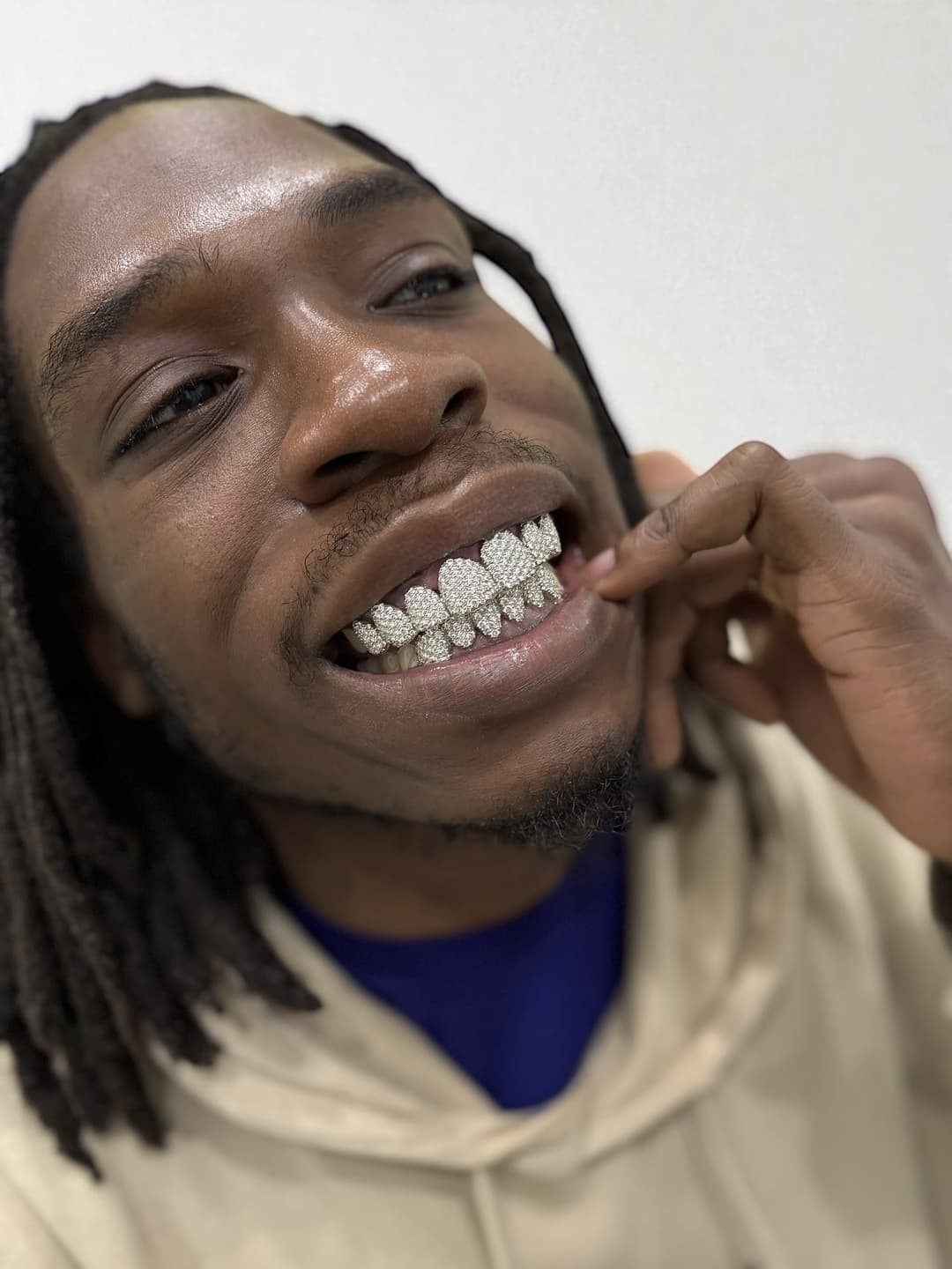 Grillz kép 2