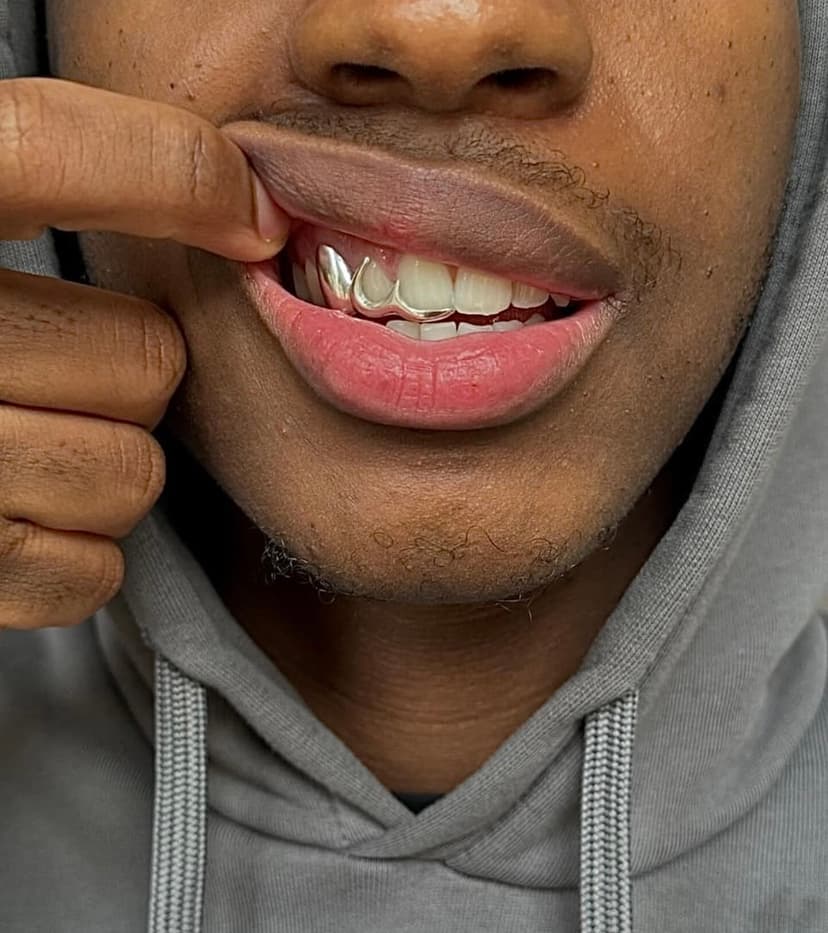 Grillz kép 3